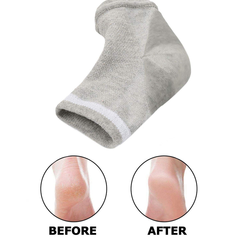 Runee Moisturizing Gel Heel Socks Open Toe For Dry, Hard, Rough, And Cracked Skin - Treatment Care For Softer Heel, 3 Pair - BeesActive Australia