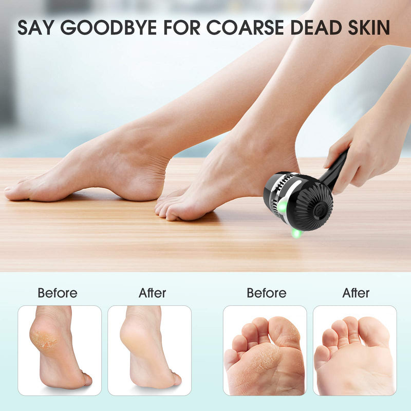 Electric Foot Callus Remover, Romanda Callus Remover for Feet,Electronic Foot File Pedicure Tools,USB Rechargeable Foot Grinder Vacuum Feet Care for Dead Hard Cracked Dry Skin, 3 Grinding Heads - BeesActive Australia