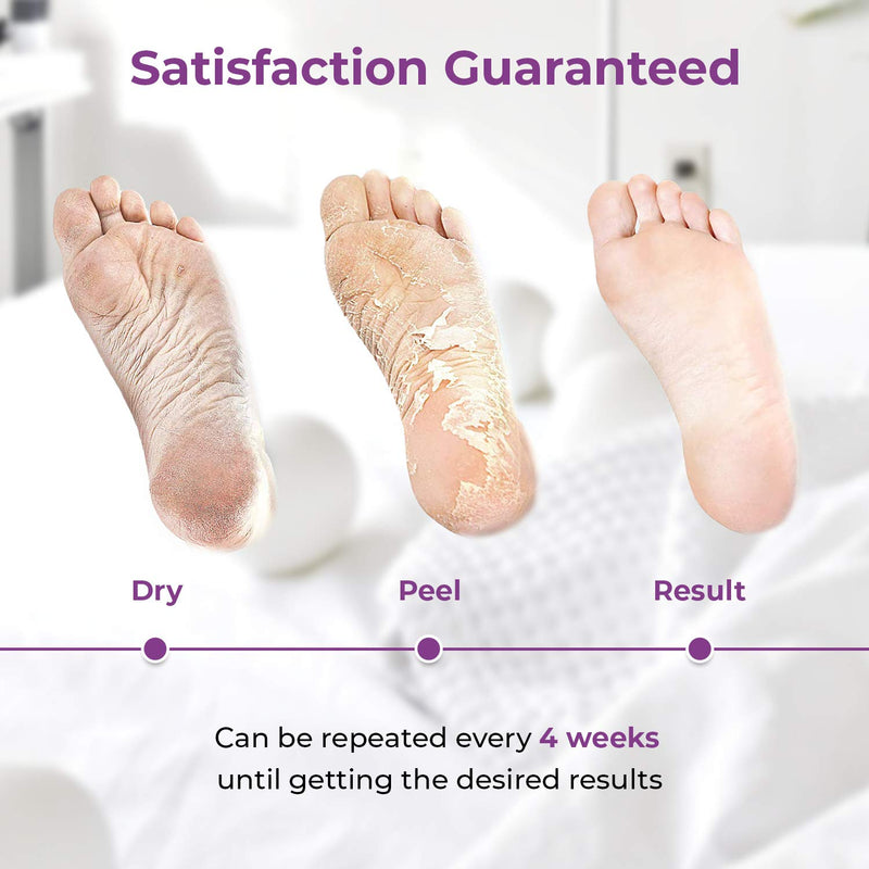 Foot Peel Mask - Make Your Feet Baby Soft, Removes Dry & Dead Skin, Exfoliating Foot Mask Natural Treatment, 2 Sets (Lavender) - BeesActive Australia