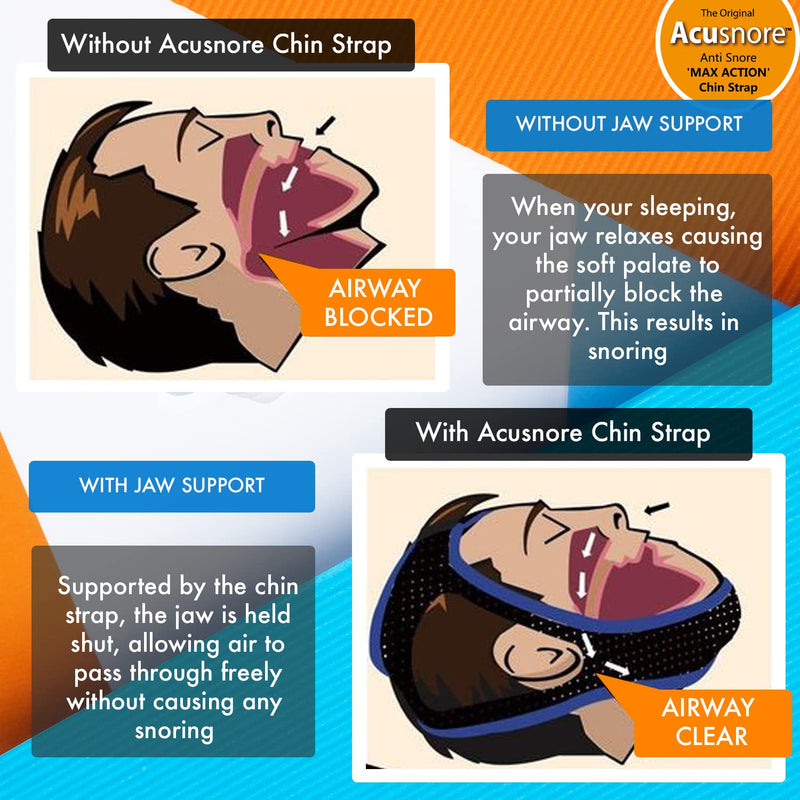 Chin Strap Snoring Aid Acusnore MAX Action® Anti Snoring Chin Strap - Adjustable Comfortable Universal Snore Stopper - BeesActive Australia