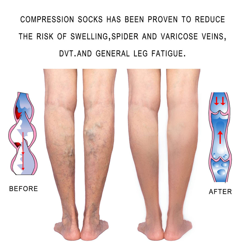 20-30 mmHg Compression Stockings for Women and Men Knee High Open Toe Beige X-Large - BeesActive Australia
