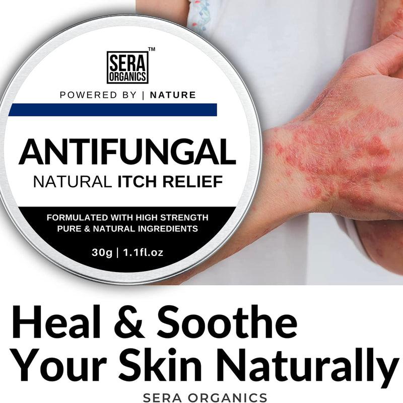 Antifungal Skin Cream - All-Natural Anti Fungal Anti-Itch Cream - Suitable For Men & Women prone to Eczema, Ringworm, Jock Itch, Athletes Foot, Nail Fungal Infections (30g) Made In UK By Sera Organics - BeesActive Australia