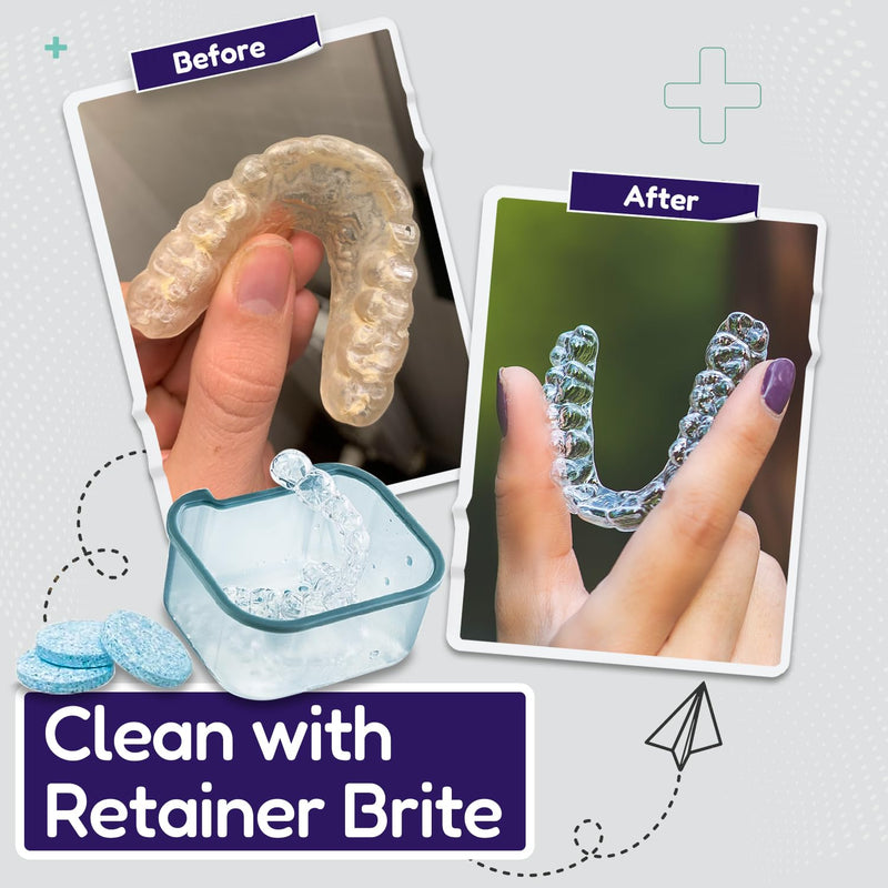 Retainer Brite Cleaning Kit Including 96 Tablets (3 Month Supply) and Case - Retainer Box Ideal for retainers, mouthguard, dentures, invisalign. Removes Plaque and Tartar. (Blue) Blue - BeesActive Australia