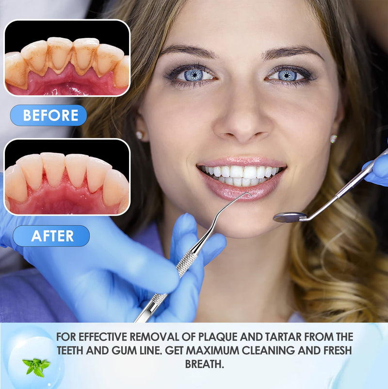 GTEX Plaque Remover for Teeth - 6Pcs Dental Care Kit for Teeth Cleaning - Plaque Removal Tartar Remover Stainless Steel Tongue Scraper Tool for Home Use - BeesActive Australia
