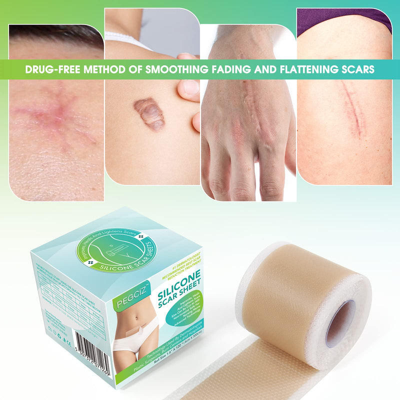Silicone Scar Removal Sheets,Fast & Effective Scar Away Silicone Scar Sheets for Acne,Keloid,Burns,Stretch Mark,C-Section Surgical Scars Treatment (1.6" x 120"Roll-3M Tape Roll) 1.6" x 120"Roll-3M Tape Roll - BeesActive Australia