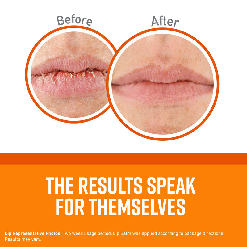 O'Keeffe's Unscented Lip Repair Lip Balm for Dry, Cracked Lips, Stick, Twin Pack, Clear, K0700432 - BeesActive Australia