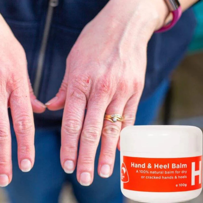 100ml Hand Heel and Foot Cream Balm for Dry Cracked Skin Treatment & Repair: 100% Natural Ingredients for Protection & Healing - BeesActive Australia
