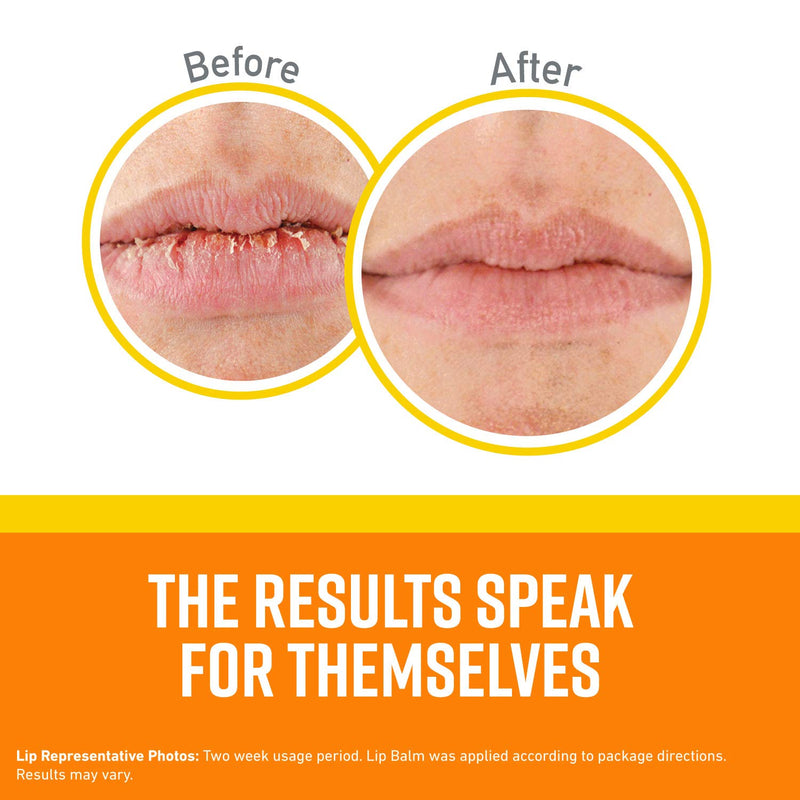 O'Keeffe's Lip Repair SPF 35 Lip Balm 1 - Pack - BeesActive Australia