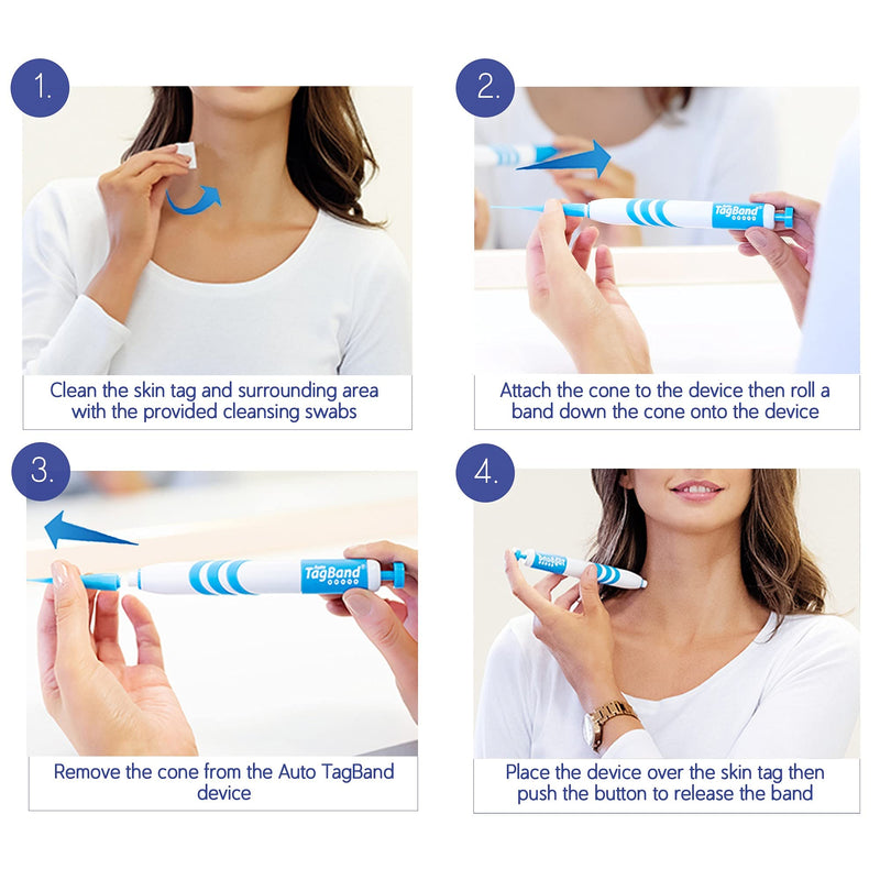 Auto TagBand Micro Skin Tag Remover Device for Small Skin Tags. Easy Application in Minutes (includes 10x Removal Bands & Cleansing Wipes) - BeesActive Australia
