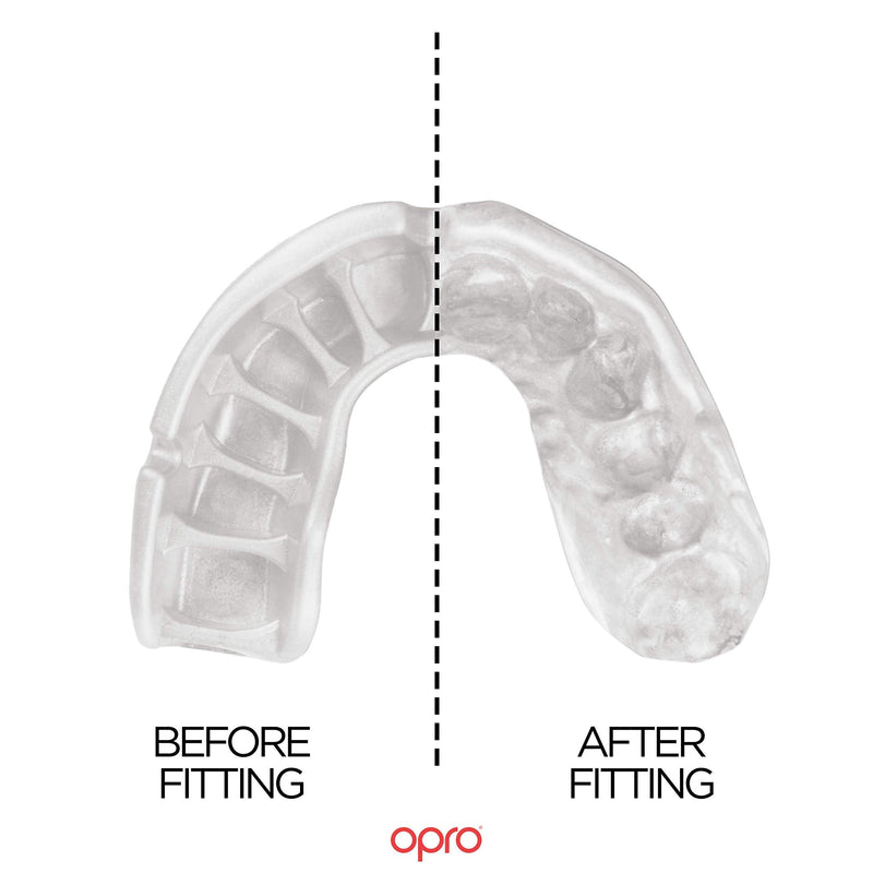 OPRO Power-Fit Mouthguard, Adults and Junior Sports Mouth Guard with Case for Boxing, Basketball, Lacrosse, Football, MMA, Martial Arts, Hockey and All Contact Sports Red Adult - BeesActive Australia