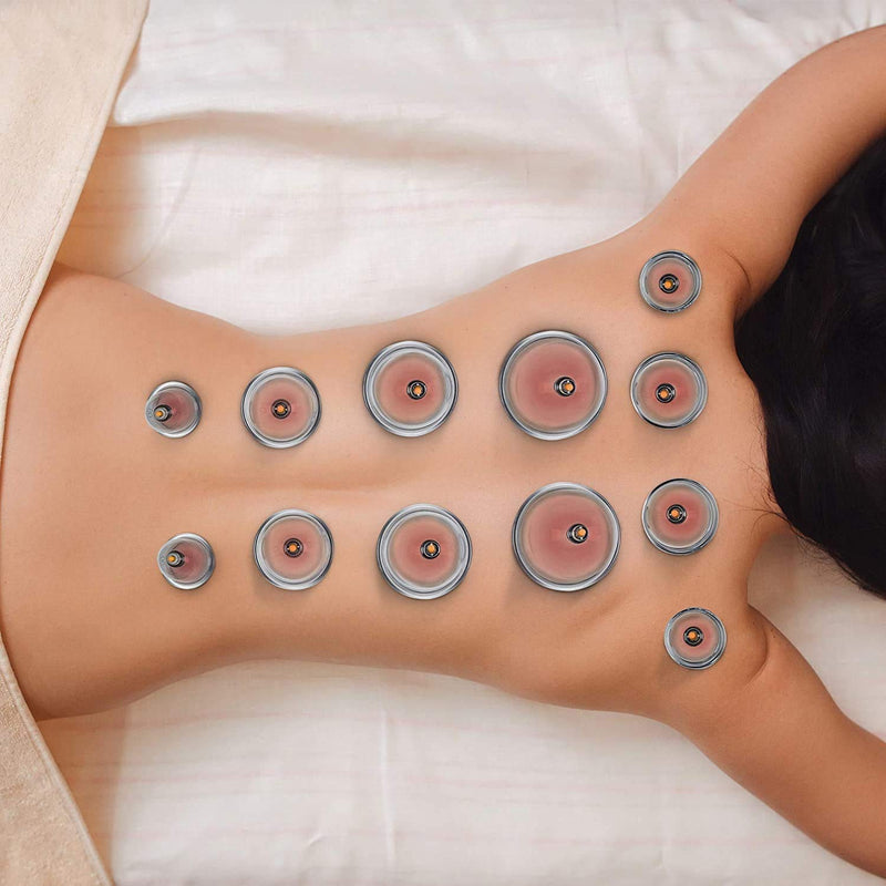 Uplife Chinese Cupping Therapy Set, 12 Vacuum Air Suction Cups with Pumping Handle, Anti Cellulite Massage for Back/Neck - BeesActive Australia