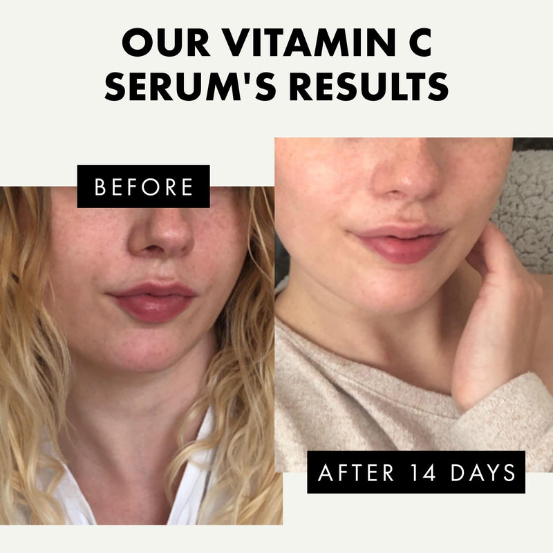 PURE Vitamin C Serum for Face 20% Vitamin C Facial Serums with Hyaluronic Acid Retinol Vit E Antioxidant Vitamin C Face Oil Skin Brightening Serum Anti Aging Reduce Wrinkles & Dark Spots Pure Vitamin C Serum - BeesActive Australia