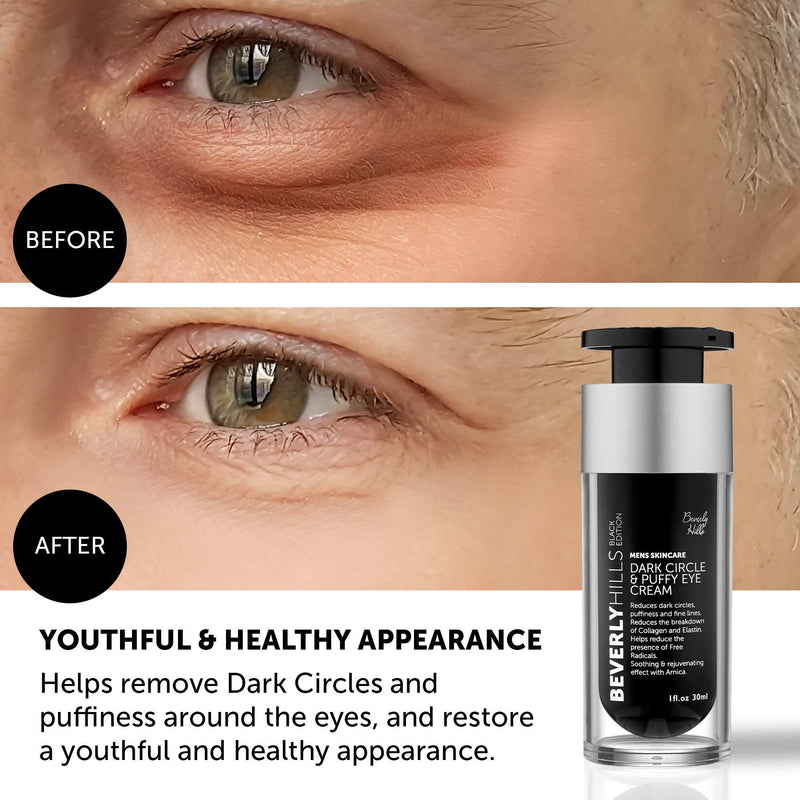 Beverly Hills Mens Eye Cream for Dark Circles, Puffy Eyes, Wrinkles and Crows Feet - BeesActive Australia