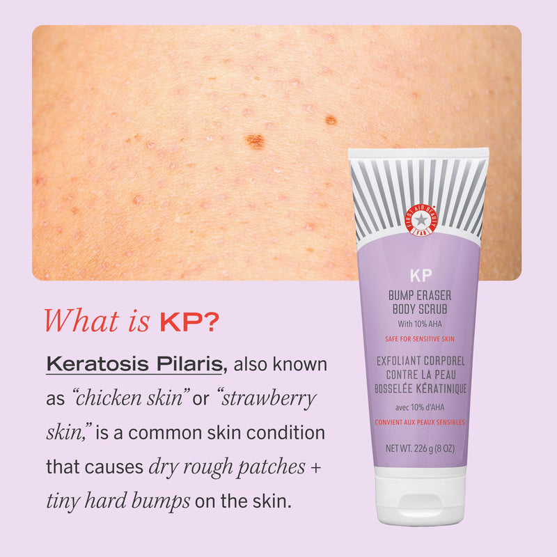 First Aid Beauty KP Bump Eraser Body Scrub, Exfoliant for Keratosis Pilaris with 10% AHA, 2 oz 56.7 g (Pack of 1) - BeesActive Australia