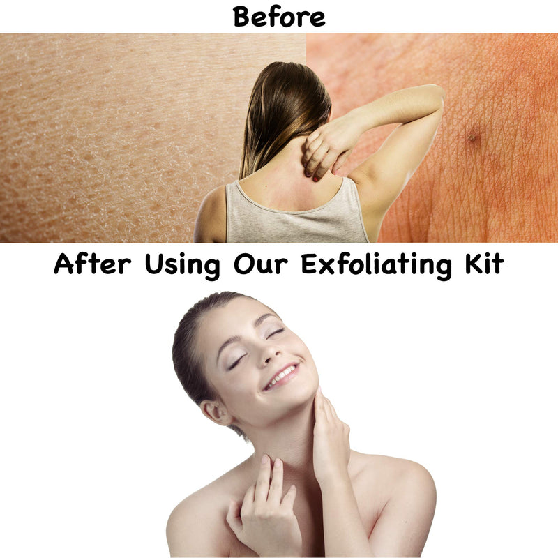 SMITCO Dead Skin Remover for Body - Exfoliating Gloves and Back Exfoliator for Men and Women - Full Body Scrubbers for Use in Shower or Bath to Improve Skin Texture and Get Rid of Bumpy Skin - BeesActive Australia