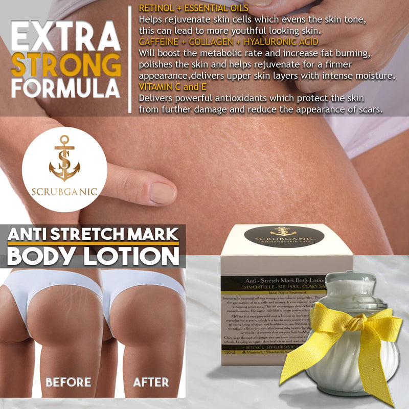 Anti Stretch Mark Body Lotion Extra Strong Formula Do not use during Pregnancy - BeesActive Australia