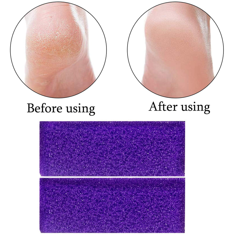 40 Pcs Pumice Stone For Feet Foot Scrubber Sponge For Feet Care and Callus Remover Mini Disposable Pumice Pads For Dead Skin Remover Purper. - BeesActive Australia