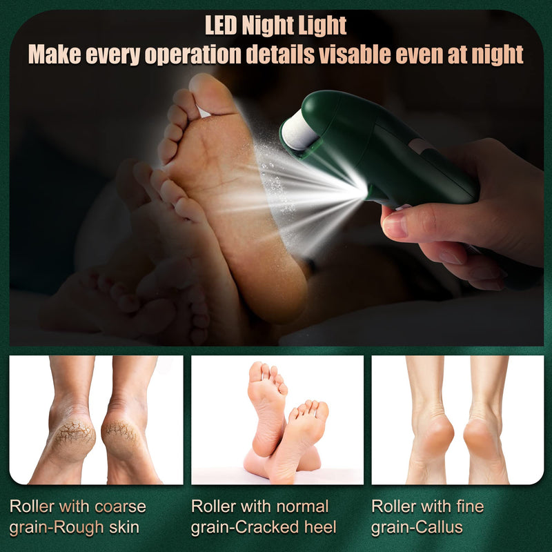 SHORAN Electric Foot File Feet Hard Skin Remover, Professional Callus Remover Foot Grinder Pedicure Foot Care Set for Dead Skin Dry Skin, USB Rechargeable with 3 Replacement Roller and 2 Foot Scraper Green Foot File - BeesActive Australia