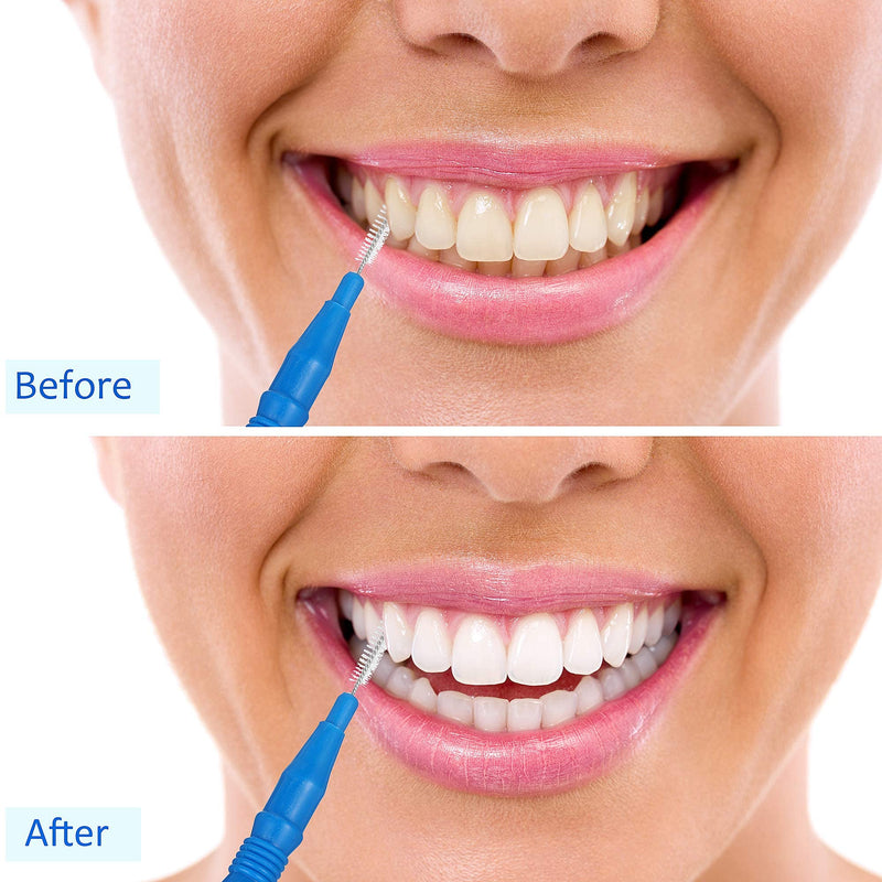 100 Pieces Braces Dental Brush Flosser for Cleaner Interdental Brush Toothpick Dental Tooth Flossing Head Oral Dental Hygiene Toothpick Cleaners Cleaning Tool Red and Blue - BeesActive Australia