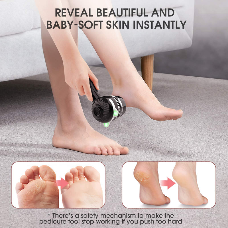 Electric Foot Callus Removers, Rechargeable Pedicure Tools Portable Foot File Callus Remover with Vacuum, Dead Skin Remover for Feet, Professional Foot Care for Women Men Hard Cracked Dry Skin - BeesActive Australia