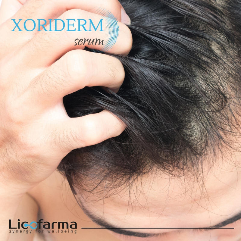 Xoriderm Serum Lotion helps in presence of Psoriasis and Dermatitis of the scalp. Soothing, moisturizing and rebalancing action. - BeesActive Australia