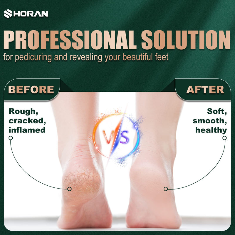 SHORAN Electric Foot File Feet Hard Skin Remover, Professional Callus Remover Foot Grinder Pedicure Foot Care Set for Dead Skin Dry Skin, USB Rechargeable with 3 Replacement Roller and 2 Foot Scraper Green Foot File - BeesActive Australia