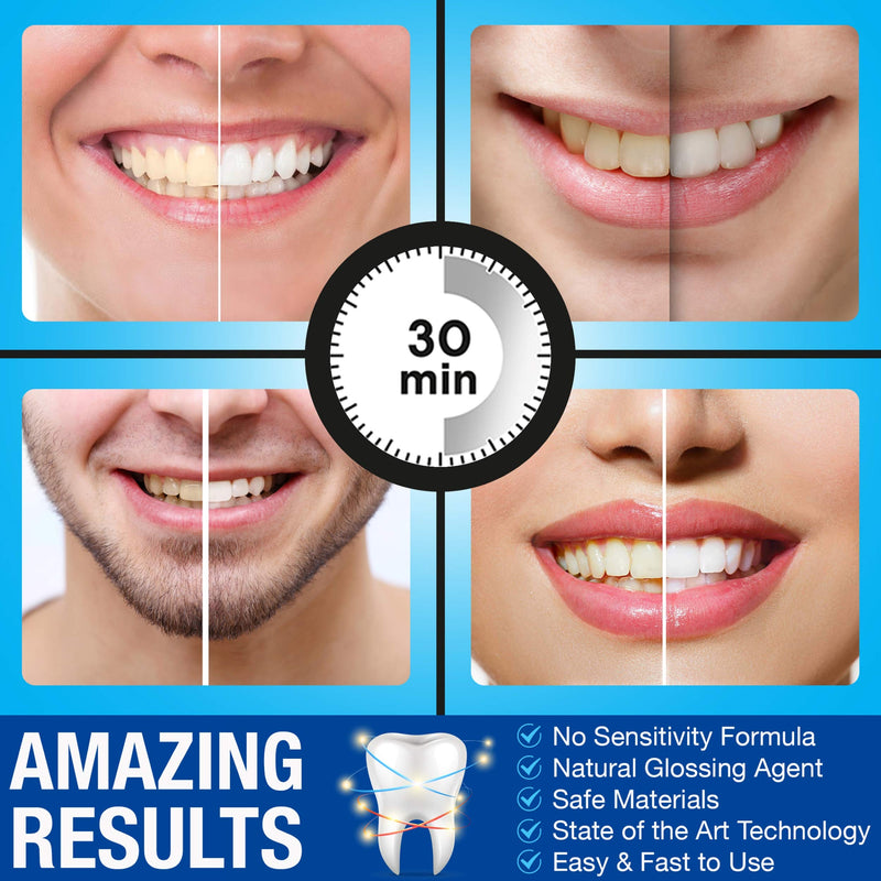 Pro Intellident Teeth Whitening Strips | Home Teeth Whitening Strips Developed by British Dentists for Instant Results - BeesActive Australia