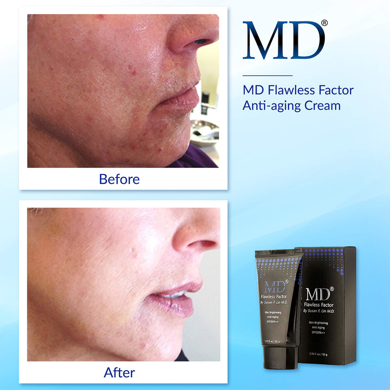 MD Flawless Factor BB Cream for coverage, Skin Brightening & Anti-aging | Anti Wrinkle Cream Moisturizer with Sun Protection | Rated SPF 35 | Suitable For All Skin Types - 1.76 Fl Oz - BeesActive Australia