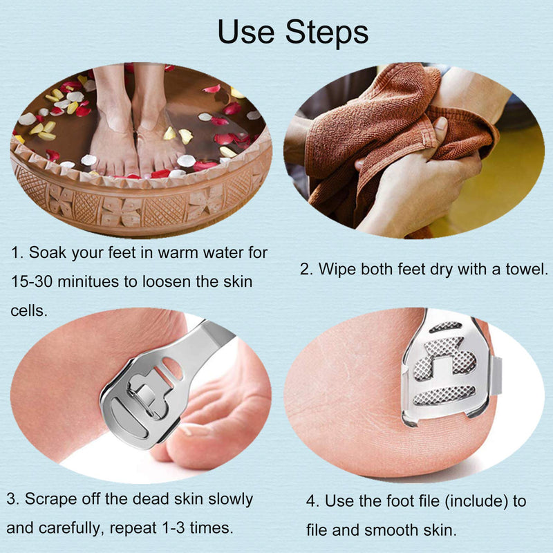 ILamourCar Foot Pedicure Callus Shaver Sets 2 Pumice Stone, including 1 Callus Shaver for Feet 1 Foot File Head 1 Dead Skin Collection Box 10 Blades and Foot scrubber Professional Foot Care Tools - BeesActive Australia