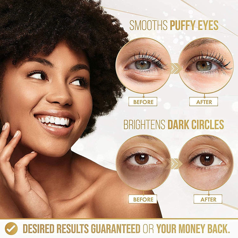 24K Gold Eye Mask– 20 Pairs - Puffy Eyes and Dark Circles Treatments – Look Less Tired and Reduce Wrinkles and Fine Lines Undereye, Revitalize and Refresh Your Skin - BeesActive Australia
