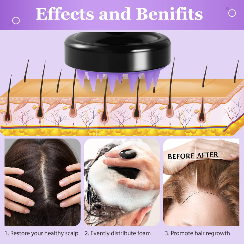 Scalp Massager Hair Shampoo Brush - Scalp Scrubber Exfoliator Cozycom Hair Scalp Massager Hair Scrubber Dandruff Brush Shower Hair Brush with Soft Long Silicone Bristles for All Hair Types - BeesActive Australia