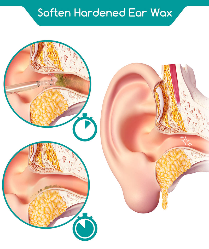 Medi Grade Sodium Bicarbonate Ear Wax Removal Drops, 10ml - 100% Natural Ear Cleaner Ear Wax Removal Kit Drops for Softening & Removing Earwax Buildup - Quick Action Ear Drops for Wax Ear Cleaning Kit - BeesActive Australia