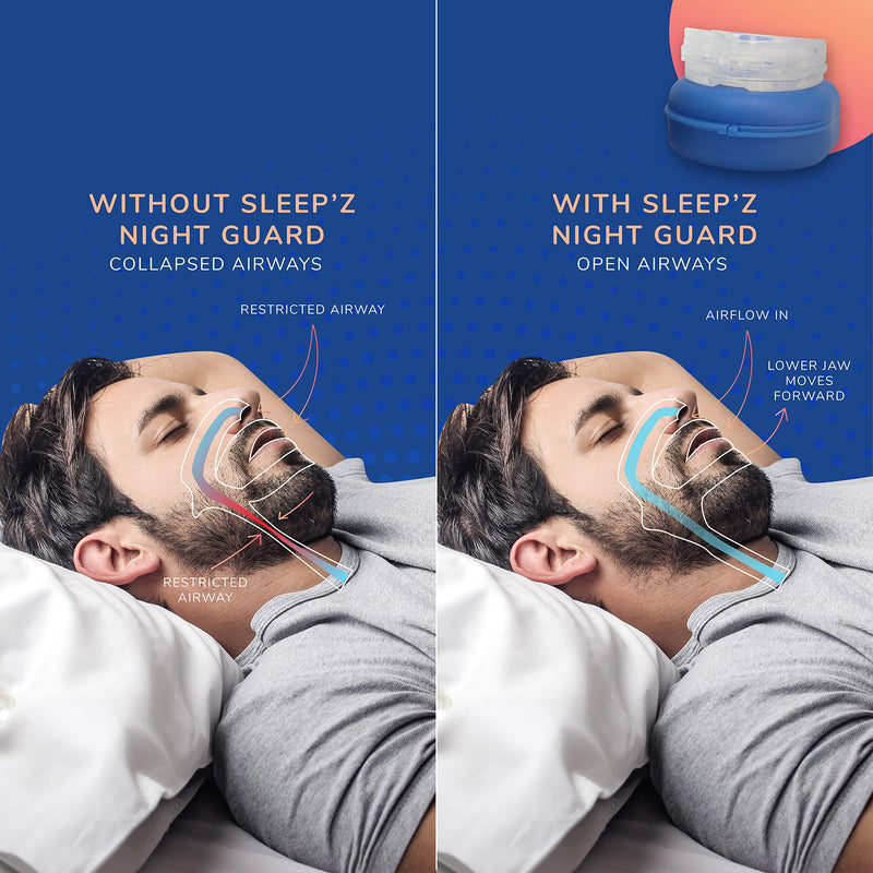 Sleep'Z Adjustable Mandibular Advancement Device - Snore Stopper, Snoring Mouth Guard with 4 Nasal Dilators, Sleep Apnea Devices, Anti Snore Mouth Guard, Anti Snoring Devices, Anti Snoring Mouthpiece - BeesActive Australia