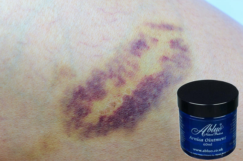 Arnica Cream Arnica Oil for Bruising Arnica Massage Arnica Bruising Swelling Bruise Cream 60 ml (Pack of 1) - BeesActive Australia