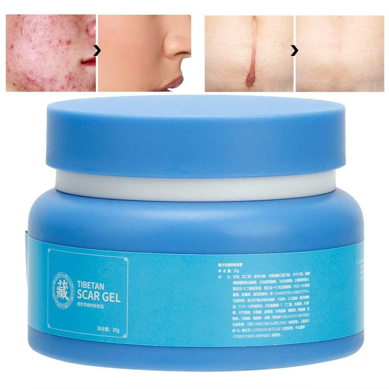 Scars Remover Cream, Scars Treatment Repairing face and body skin cream for surgical scar scars, stretch marks 30g - BeesActive Australia