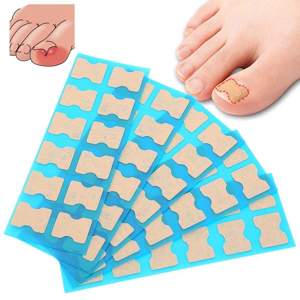 Ingrown Toenail Stick Patch, 4 Sizes Glue-free Toe Nail Correction File Patch Paronychia Corrector Foot Care Treatment Pedicure Tool Ingrown Toenail Correction Patch(2#) 2# - BeesActive Australia